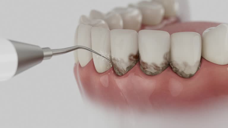 Trusted Tooth Extraction service in Morgan Hill, CA - Dentist Open Now